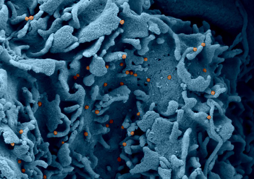 Visualisation en microscopie ��lectronique d��une cellule infect��e par le SARS-CoV-2.  ?Philippe Roingeard, Anne Bull-Maurer, Sonia Georgeault/Inserm.licence CC-BY-NC 4.0 international