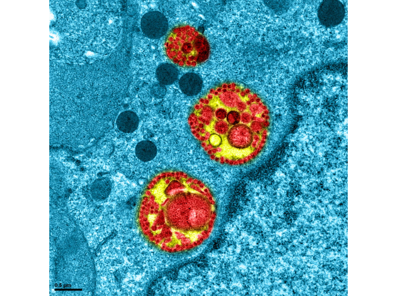 Immunit�� CIRI - Covid19