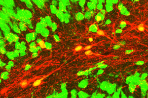 CP - INSERM/CRNL